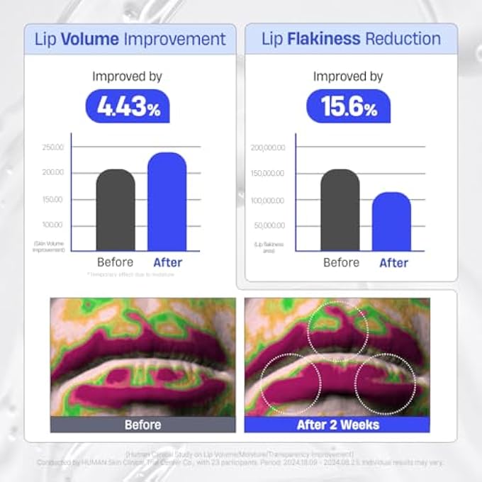 DERMATORY HYALLURON PEPTIDE VOLUME LIP MASK BALM - HYDRATING & MOISTURIZING LIP MASK FOR DAY & NIGHT CARE (10ML) - Image 4